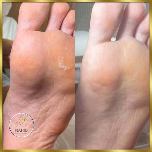 گالری پدیکور